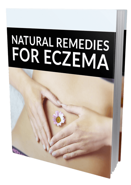 Natural Remedies for Eczema